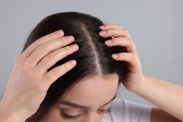 scalp health