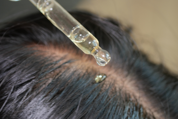 rosemary oil for hair growth