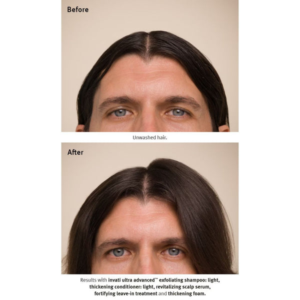 Aveda Invati Ultra Advanced Revitalizing Scalp Serum 150ml